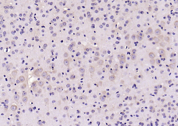 14-3-3 Rabbit Polyclonal Antibody