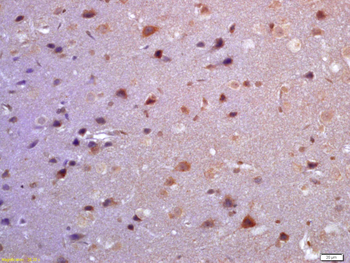 TSSC3 Rabbit Polyclonal Antibody