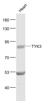 FER Rabbit Polyclonal Antibody