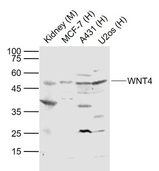 WNT4 Rabbit Polyclonal Antibody