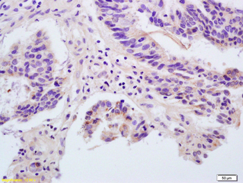 Angiopoietin-1 Rabbit Polyclonal Antibody