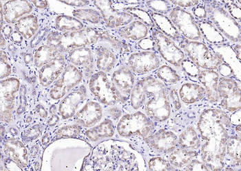 Angiopoietin-1 Rabbit Polyclonal Antibody
