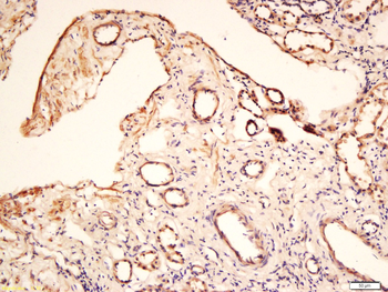 Angiopoietin-1 Rabbit Polyclonal Antibody