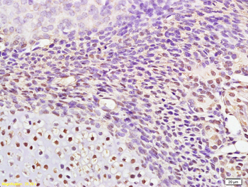 AP2 gamma Rabbit Polyclonal Antibody
