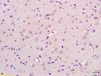 AP2 gamma Rabbit Polyclonal Antibody