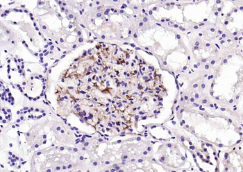 Laminin Beta 2 Rabbit Polyclonal Antibody
