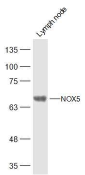 NOX5 Rabbit Polyclonal Antibody