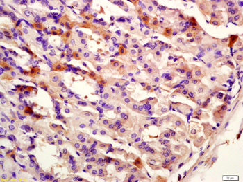 CK12 Rabbit Polyclonal Antibody