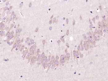 CDCREL Rabbit Polyclonal Antibody