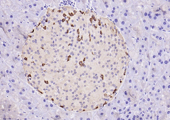 GRPP Rabbit Polyclonal Antibody