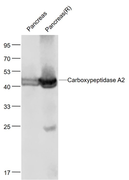 Carboxypeptidase A2 Rabbit Polyclonal Antibody