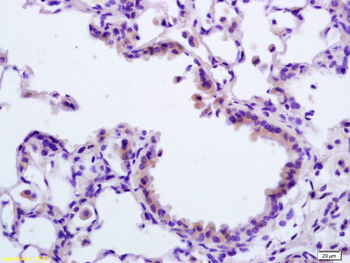 APAF1 (NT) Rabbit Polyclonal Antibody