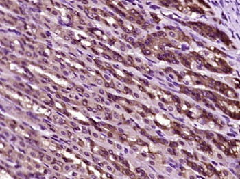 RND3 Rabbit Polyclonal Antibody