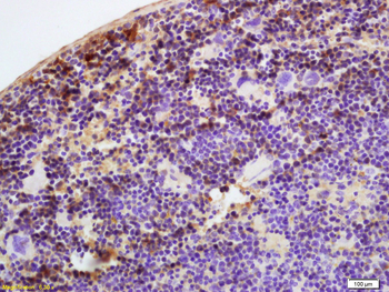 SERPINC1 Rabbit Polyclonal Antibody
