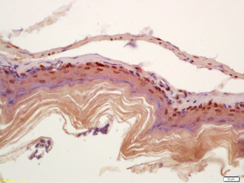 CIDEC Rabbit Polyclonal Antibody