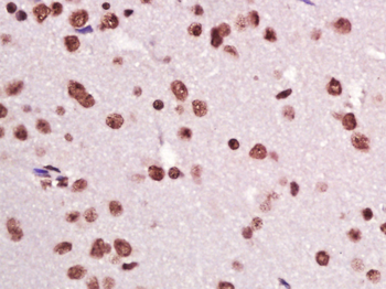 CIDEC Rabbit Polyclonal Antibody