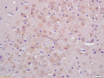 ASB3 Rabbit Polyclonal Antibody