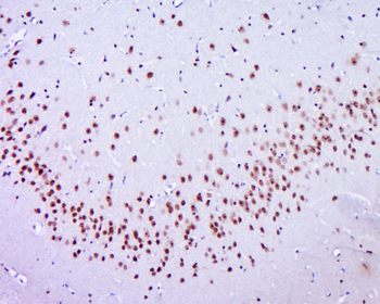 ANKRD28 Rabbit Polyclonal Antibody