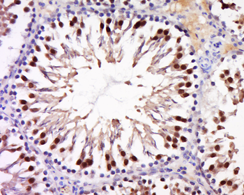 ANKRD28 Rabbit Polyclonal Antibody