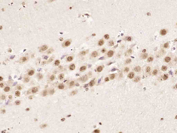HnRNP K Rabbit Polyclonal Antibody