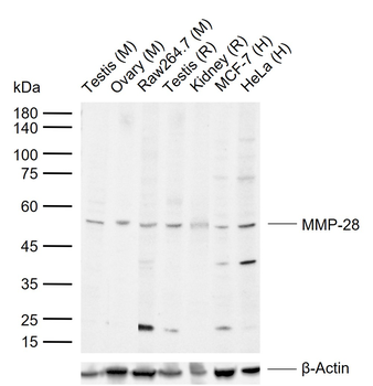 MMP-28 Rabbit Polyclonal Antibody