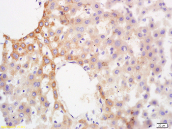 Glucokinase regulatory protein Rabbit Polyclonal Antibody