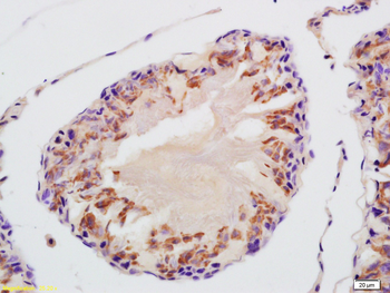 VDAC3 Rabbit Polyclonal Antibody