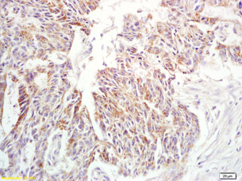 IL-6 Rabbit Polyclonal Antibody