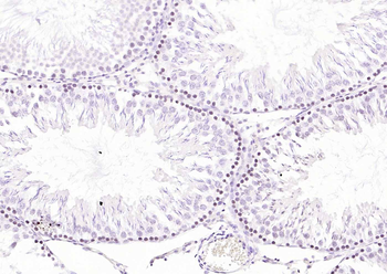 CDCA5 Rabbit Polyclonal Antibody