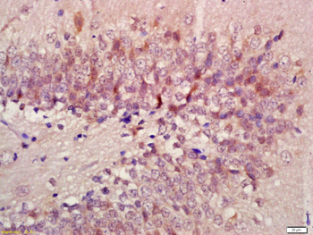 Beta arrestin 2 Rabbit Polyclonal Antibody