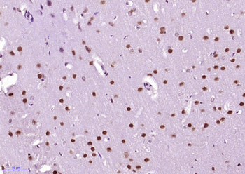 Beta arrestin 2 Rabbit Polyclonal Antibody