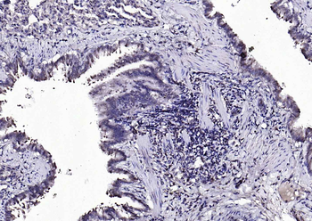 Beta arrestin 2 Rabbit Polyclonal Antibody