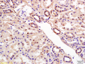 RCL Rabbit Polyclonal Antibody