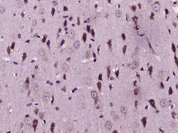 MMP-1 Rabbit Polyclonal Antibody