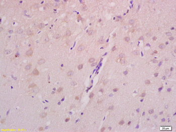 Axin 2 Rabbit Polyclonal Antibody