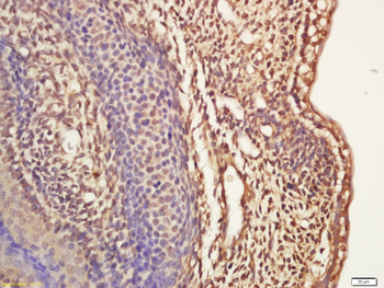 ASCL1 Rabbit Polyclonal Antibody