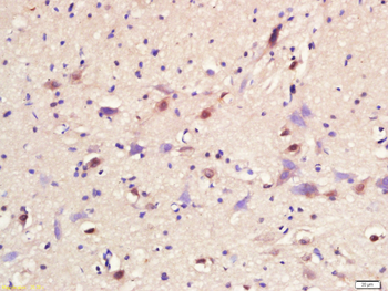 ASCL1 Rabbit Polyclonal Antibody