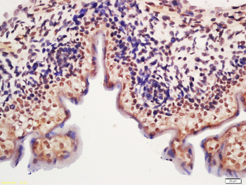METTL11A Rabbit Polyclonal Antibody