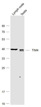 TIM4 Rabbit Polyclonal Antibody
