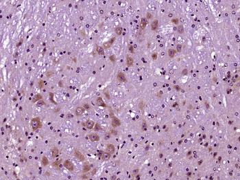 SIRT1 Rabbit Polyclonal Antibody