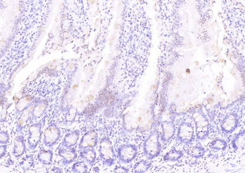 ATF4 Rabbit Polyclonal Antibody