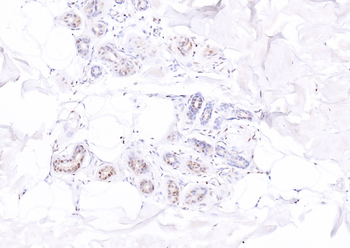 ATF4 Rabbit Polyclonal Antibody