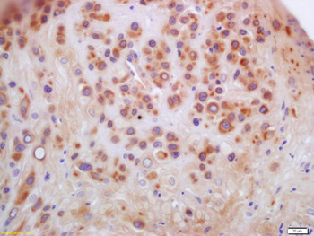 Anillin Rabbit Polyclonal Antibody