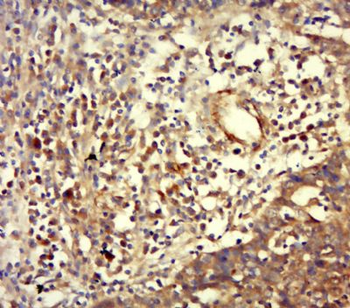 EMT Research Antibody Assembly kit (E-Cadherin,N-Cadherin,Vimentin,Occludin,ZO-1)