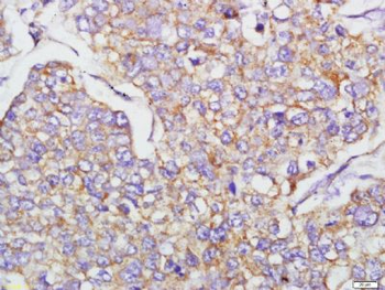 EMT Research Antibody Assembly kit (E-Cadherin,N-Cadherin,Vimentin,Occludin,ZO-1)