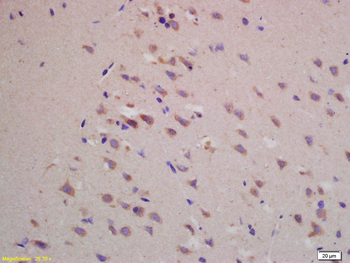 BACE1 Rabbit Polyclonal Antibody
