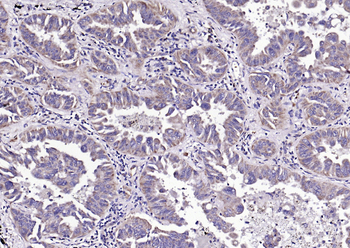 Bad Rabbit Polyclonal Antibody