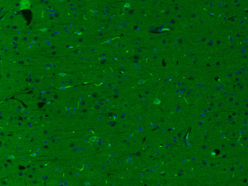 HRG beta 1 Rabbit Polyclonal Antibody