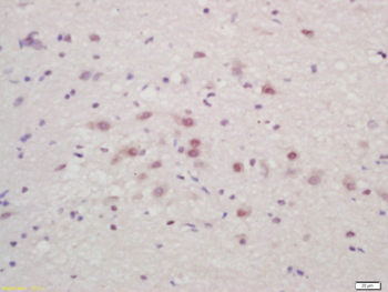 Bassoon Rabbit Polyclonal Antibody