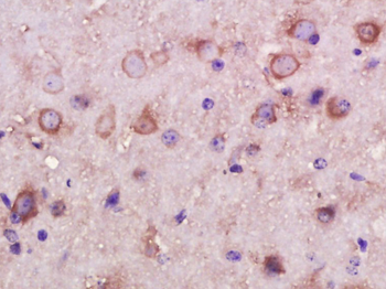 INPPL1 Rabbit Polyclonal Antibody